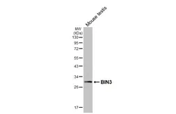 Anti-BIN3 antibody [HL5959] used in Western Blot (WB). GTX647571