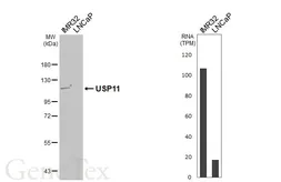 Anti-USP11 antibody [HL5963] used in Western Blot (WB). GTX647577