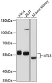 Anti-ATL3 antibody used in Western Blot (WB). GTX64758