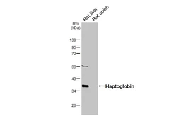 Anti-Haptoglobin antibody [HL5968] used in Western Blot (WB). GTX647582