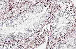 Anti-MSH2 antibody [HL5972] used in IHC (Paraffin sections) (IHC-P). GTX647586