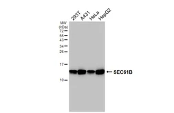 Anti-SEC61B antibody [HL5984] used in Western Blot (WB). GTX647598