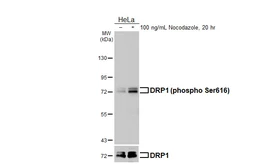 Anti-DRP1 (phospho Ser616) antibody [HL5985] used in Western Blot (WB). GTX647599