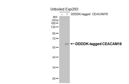 Anti-CEACAM18 Antibody [HL5988] used in Western Blot (WB). GTX647602