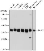 Anti-LASP1 antibody used in Western Blot (WB). GTX64762