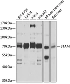 Anti-STAM antibody used in Western Blot (WB). GTX64764