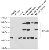 Anti-Nogo Receptor antibody used in Western Blot (WB). GTX64766