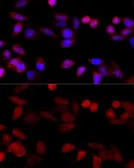 Anti-CYP1B1 antibody used in Immunocytochemistry/ Immunofluorescence (ICC/IF). GTX64767