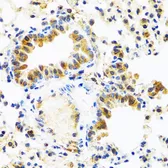 Anti-C8orf4 antibody used in IHC (Paraffin sections) (IHC-P). GTX64775