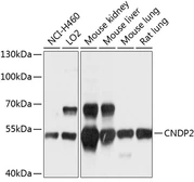 Anti-CNDP2 antibody used in Western Blot (WB). GTX64780