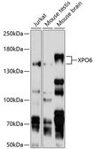 Anti-XPO6 antibody used in Western Blot (WB). GTX64781