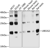 Anti-UBE2G2 antibody used in Western Blot (WB). GTX64782