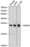 Anti-RAIDD antibody used in Western Blot (WB). GTX64784