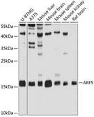 Anti-ARF5 antibody used in Western Blot (WB). GTX64788