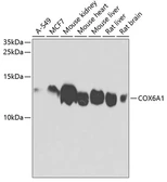 Anti-COX6A1 antibody used in Western Blot (WB). GTX64790
