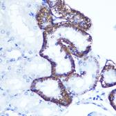 Anti-EXTL3 antibody used in IHC (Paraffin sections) (IHC-P). GTX64791
