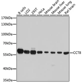Anti-TCP1 theta antibody used in Western Blot (WB). GTX64792