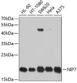 Anti-NIP7 antibody used in Western Blot (WB). GTX64793