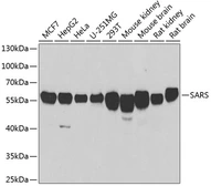 Anti-Seryl-tRNA synthetase antibody used in Western Blot (WB). GTX64795