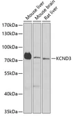 Anti-Kv4.3 antibody used in Western Blot (WB). GTX64796