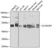 Anti-NHERF1 antibody used in Western Blot (WB). GTX64798