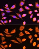 Anti-RPS20 antibody used in Immunocytochemistry/ Immunofluorescence (ICC/IF). GTX64800