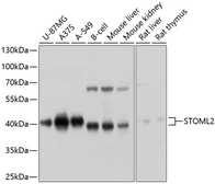 Anti-STOML2 antibody used in Western Blot (WB). GTX64801