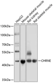 Anti-AChR epsilon antibody used in Western Blot (WB). GTX64807