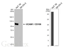 Anti-VCAM1 / CD106 antibody [HL5998] used in Western Blot (WB). GTX648072