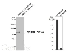 Anti-VCAM1 / CD106 antibody [HL5999] used in Western Blot (WB). GTX648073