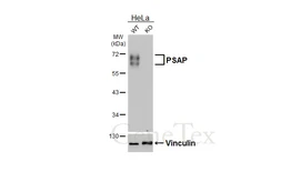 Anti-PSAP antibody [HL6003] used in Western Blot (WB). GTX648077