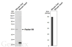 Anti-Factor VII antibody [HL6005] used in Western Blot (WB). GTX648079