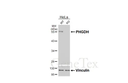 Anti-PHGDH antibody [HL6006] used in Western Blot (WB). GTX648080