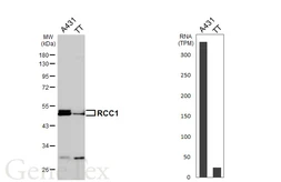 Anti-RCC1 antibody [HL6010] used in Western Blot (WB). GTX648084