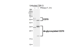 Anti-CD70 antibody [HL6015] used in Western Blot (WB). GTX648089