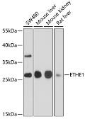 Anti-ETHE1 antibody used in Western Blot (WB). GTX64809