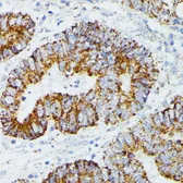 Anti-ETHE1 antibody used in IHC (Paraffin sections) (IHC-P). GTX64809