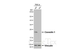 Anti-Caveolin 1 antibody [HL6038] used in Western Blot (WB). GTX648112