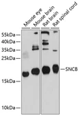 Anti-beta Synuclein antibody used in Western Blot (WB). GTX64812