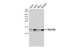 Anti-SEC61B antibody [HL6048] used in Western Blot (WB). GTX648127