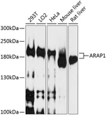 Anti-ARAP1 antibody used in Western Blot (WB). GTX64813