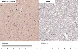 Anti-RAB39B antibody [HL6059] used in IHC (Paraffin sections) (IHC-P). GTX648138