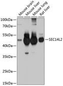 Anti-SEC14L2 antibody used in Western Blot (WB). GTX64814