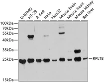 Anti-RPL18 antibody used in Western Blot (WB). GTX64815