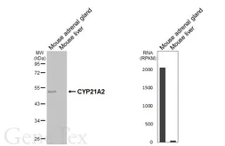 Anti-CYP21A2 antibody [HL6072] used in Western Blot (WB). GTX648151