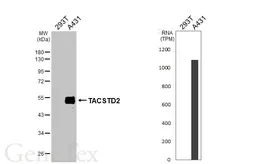 Anti-TACSTD2 antibody [HL6077] used in Western Blot (WB). GTX648156