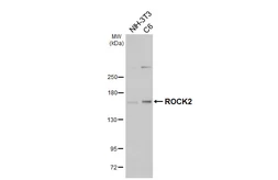 Anti-ROCK2 antibody [HL6079] used in Western Blot (WB). GTX648158