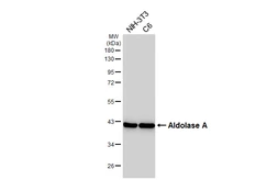 Anti-Aldolase A antibody [HL6080] used in Western Blot (WB). GTX648159