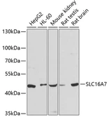 Anti-MCT2 antibody used in Western Blot (WB). GTX64816