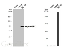 Anti-EPX antibody [HL6083] used in Western Blot (WB). GTX648162